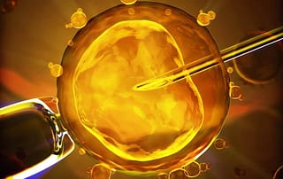 IVF vorbereiten