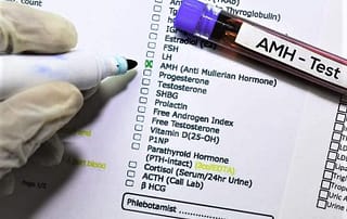 AMH Wert Anti Müller Hormon Werte Test