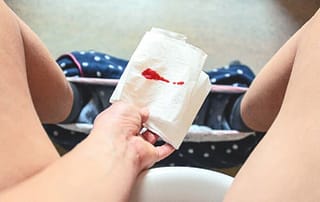 Wie sieht das Blut bei einer Fehlgeburt aus