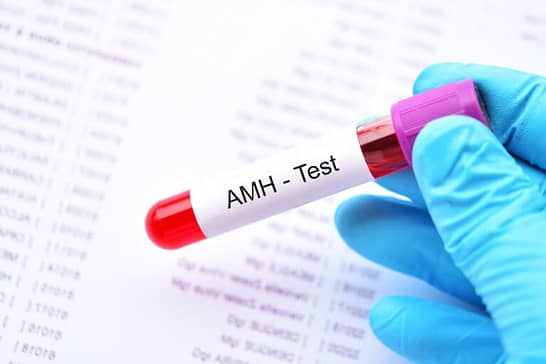 AMH Wert Tabelle - AMH Normwerte erklärt
